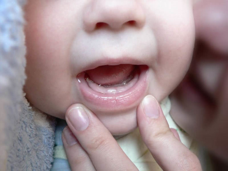 When Do Baby Teeth Develop: A Guide for Parents